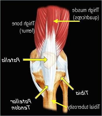 膝关节图，显示髌骨、胫骨和髌骨肌腱的位置